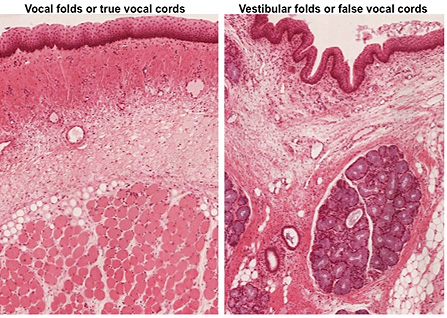true and false vocal cords model