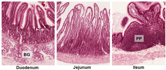 histology of ileum peyers patches