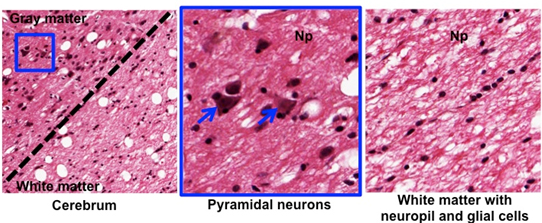 cerebral cortex histology labeled